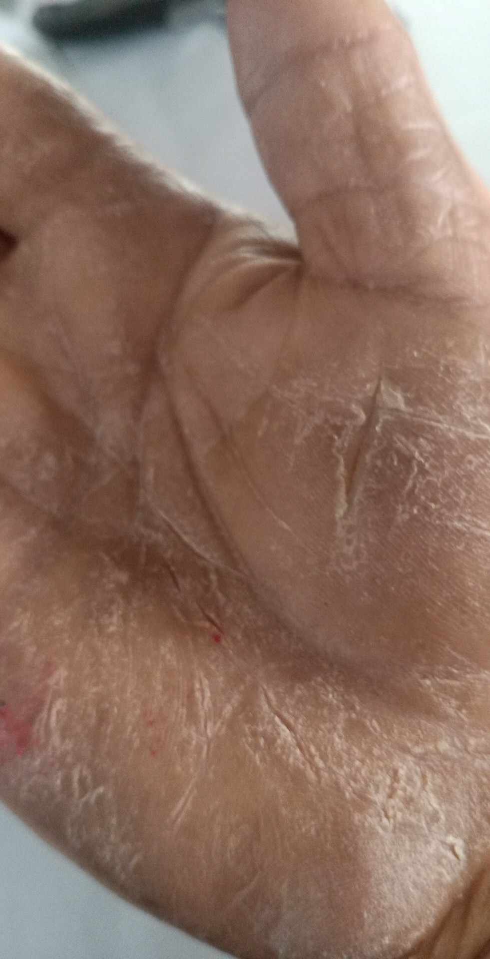 Before image