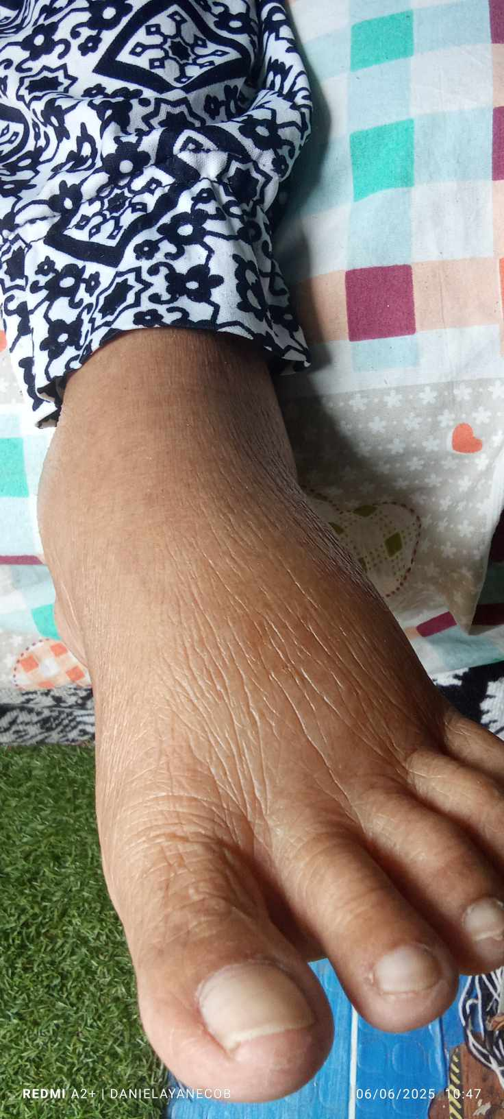 After image