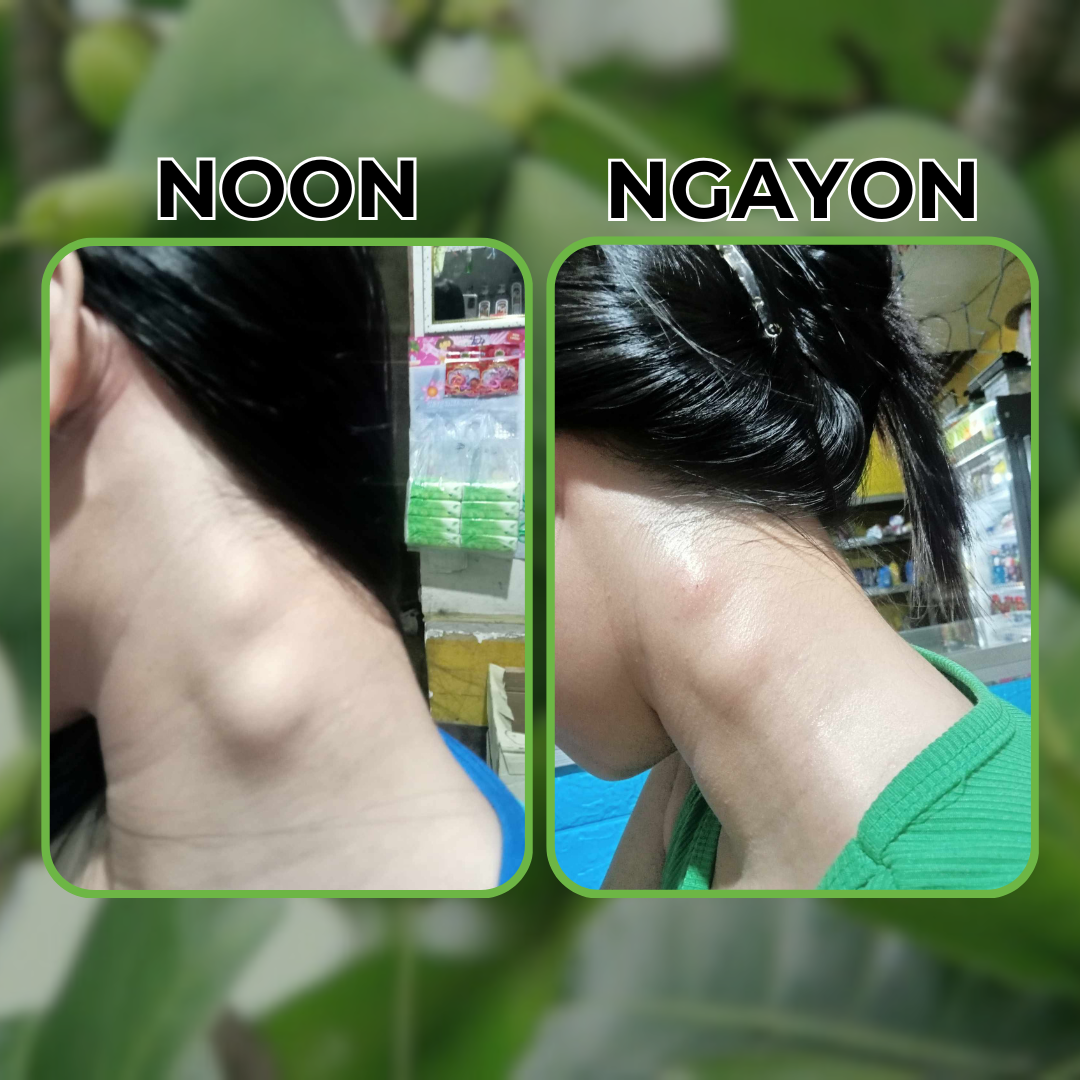 Bitoon Herbal Oil (Buy 1 Get 1)